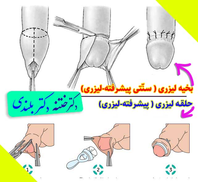 کلینیک ختنه نوزادان و کودکان دکتر بلندی